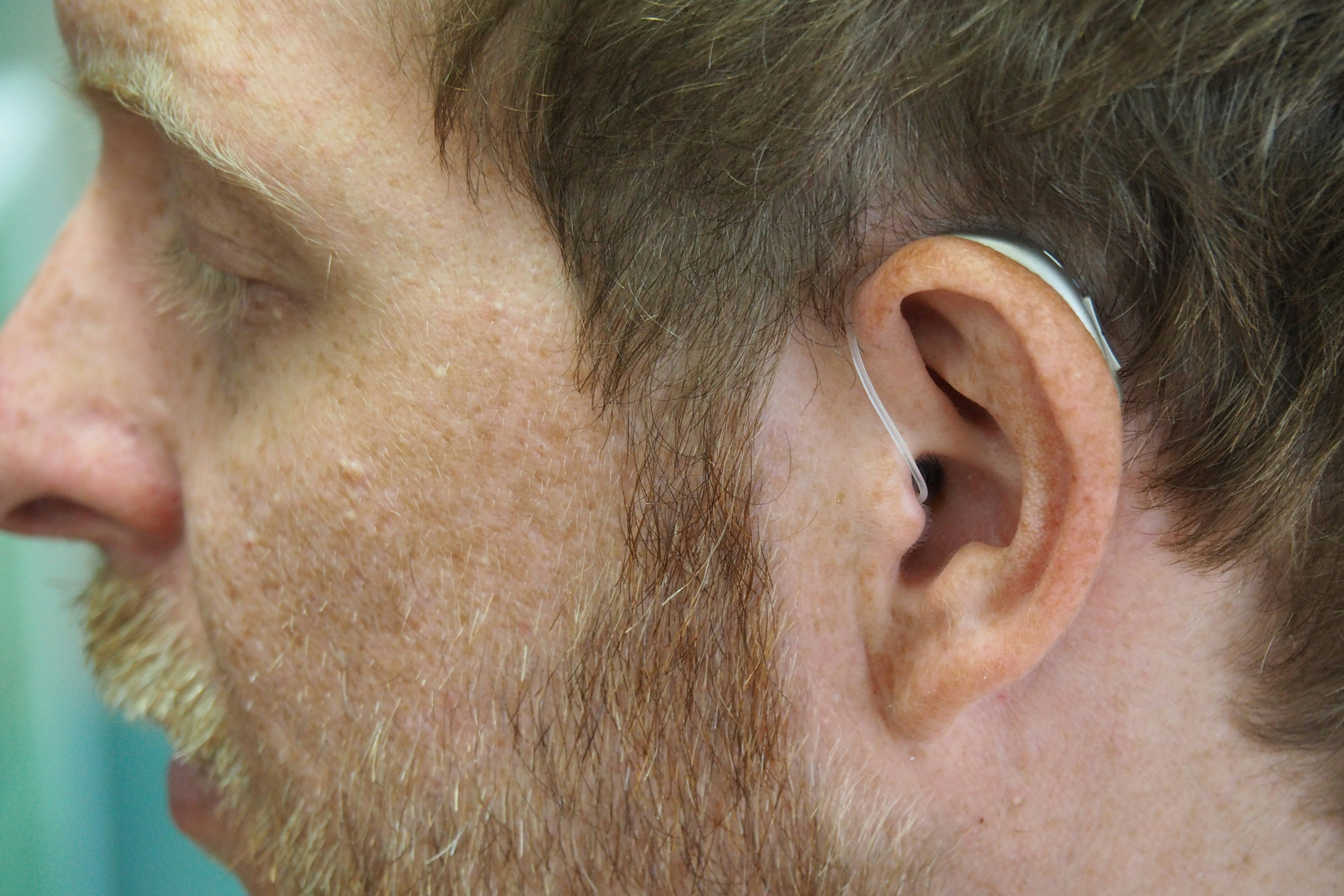 Hearing aids